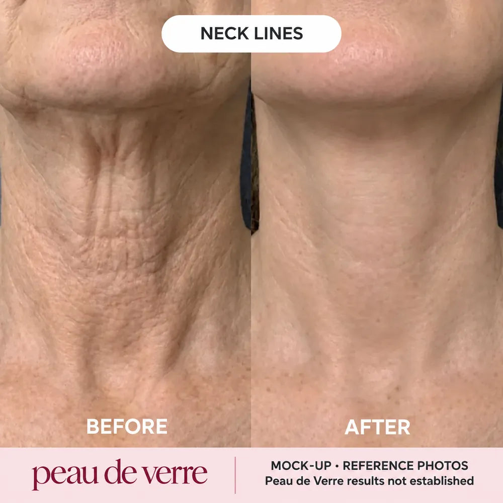 Collagen Neck & Décolleté Mask