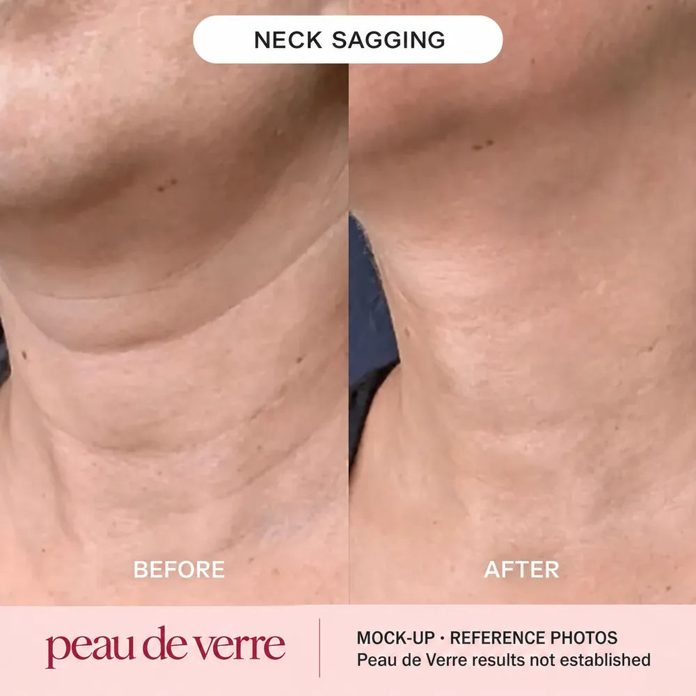 Collagen Neck & Décolleté Mask