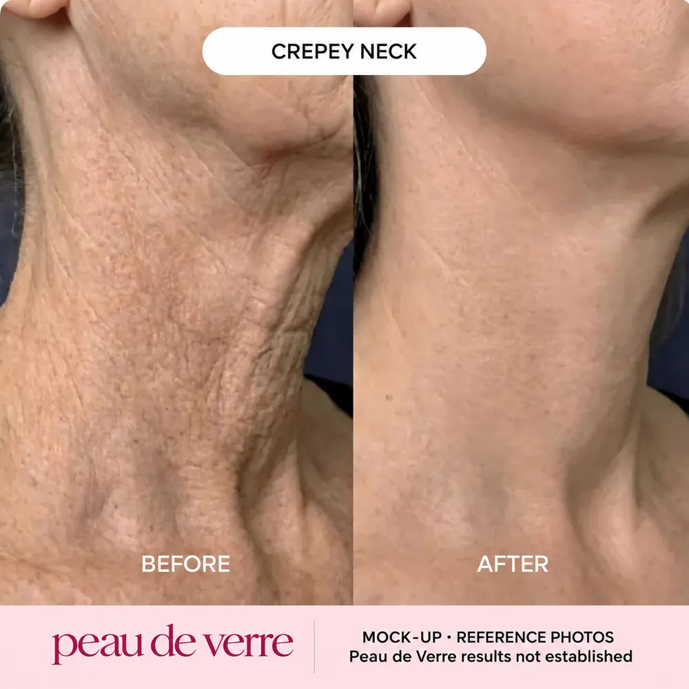 Collagen Neck & Décolleté Mask